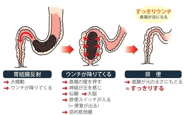 拒食症は便秘を引き起こす可能性がありますか?
